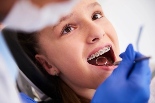 Ortodoncia brackets Ortodoncia brackets