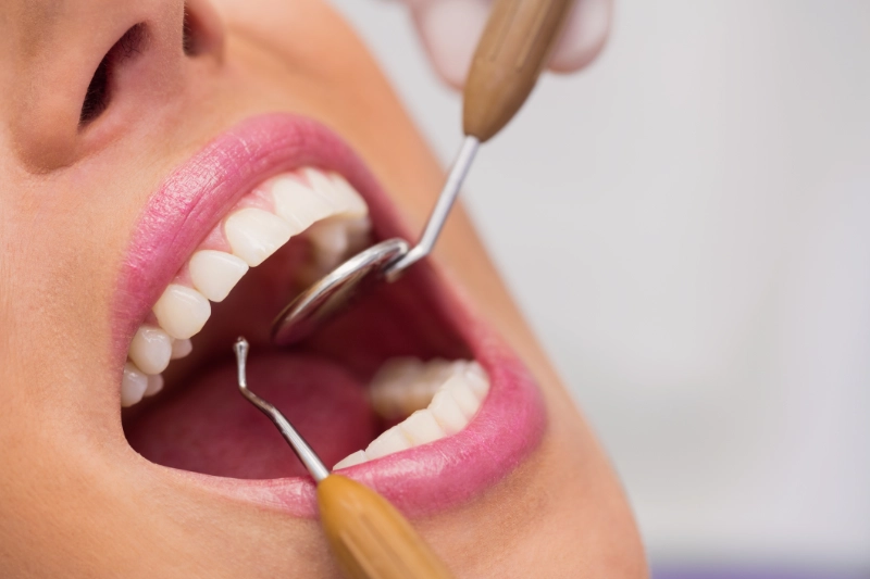 Periodoncia Cabezo de torres Periodoncia Cabezo de torres